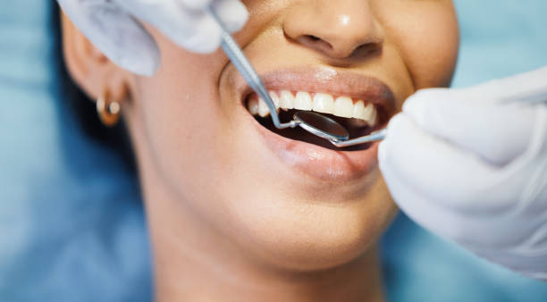 Best Emergency Care for Gum Disease in Capac, MI