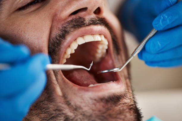 Best Emergency Denture Repair in Capac, MI