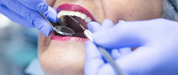 Best Emergency Treatment for Oral Infections in Capac, MI